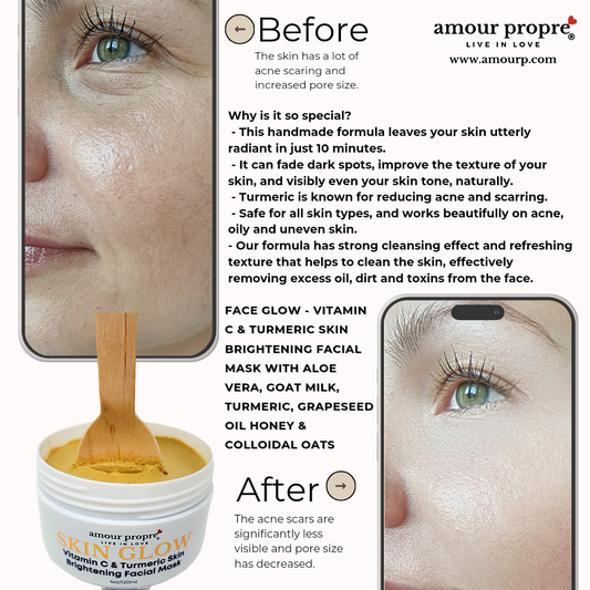 Skin Glow Facial Care Solution – Foaming Facial Wash & Brightening Mask Skin Glow Kit – Turmeric Face Cream & Skin Brightening Products Facial Brightening Solution – Foaming Wash, Mask, and Cream Skin Glow Trio – Cleanse, Brighten, and Hydrate Your Face T