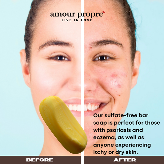 Eczema Relief Chamomile, Calendula & Orange Blossom Facial Bar 3oz